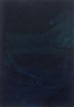 Untitled (Tattoo Removal, Right Pelvis)